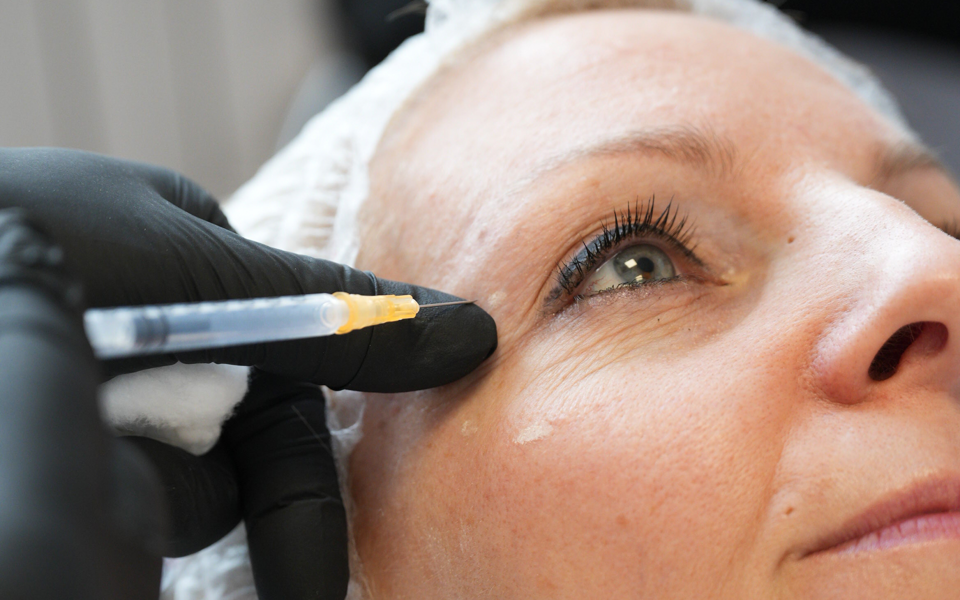Foto medicina estetica e dermatologia